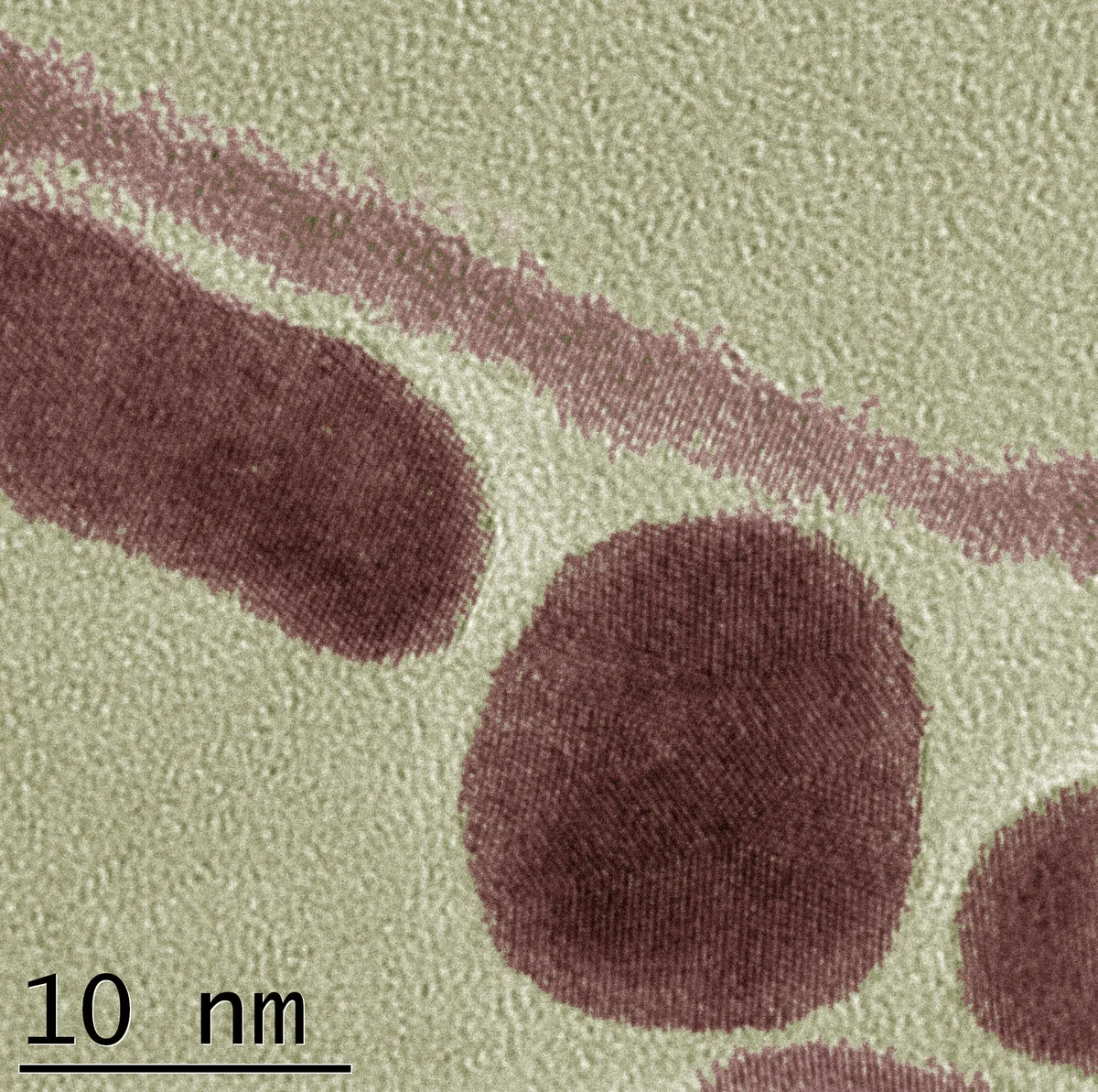 10 nanometre ölçekli transmisyon elektron mikroskobu (TEM) görüntüsünde altın nanopartikülleri ve nanoçubukları — altın bazlı katalizörlerin yapı taşları