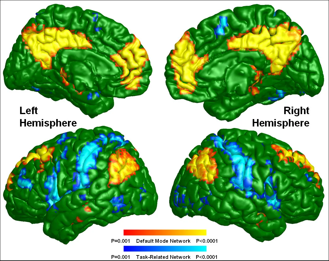 Varsayılan Mod Ağı'nı sarı-kırmızı renkte gösteren, sol ve sağ beyin yarım kürelerinin karşılaştırıldığı bilimsel fMRI beyin haritası